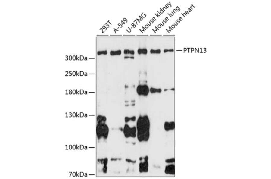 Western Blot - Anti-PTPN13/FAP-1 Antibody (A89201) - Antibodies.com