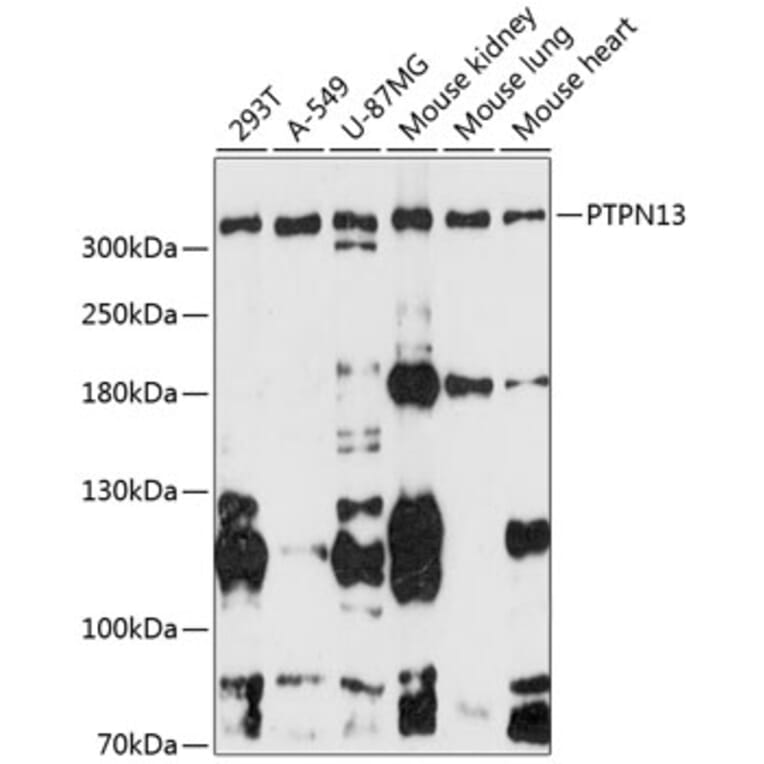Western Blot - Anti-PTPN13/FAP-1 Antibody (A89201) - Antibodies.com