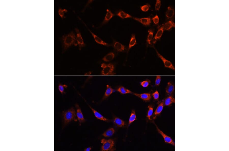 Immunofluorescence - Anti-PTPN13/FAP-1 Antibody (A89201) - Antibodies.com