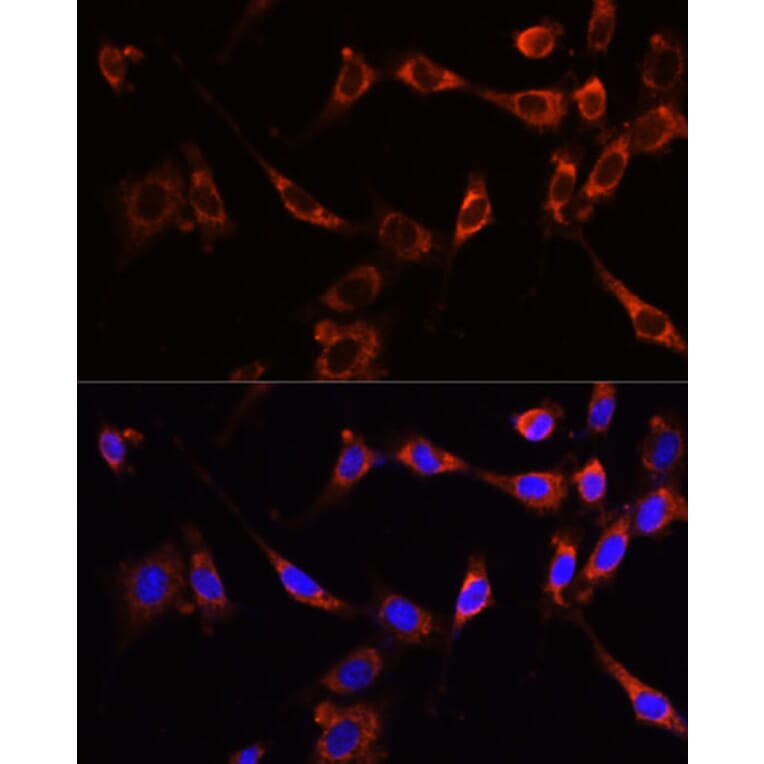 Immunofluorescence - Anti-PTPN13/FAP-1 Antibody (A89201) - Antibodies.com