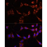 Immunofluorescence - Anti-PTPN13/FAP-1 Antibody (A89201) - Antibodies.com