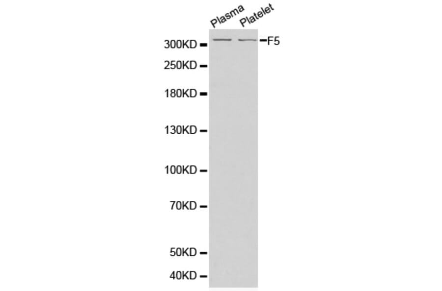Western Blot - Anti-F5 Antibody (A1292) - Antibodies.com