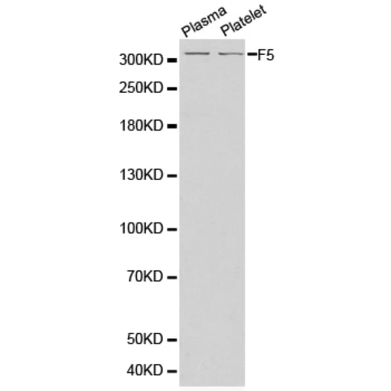 Western Blot - Anti-F5 Antibody (A1292) - Antibodies.com