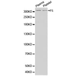 Western Blot - Anti-F5 Antibody (A1292) - Antibodies.com