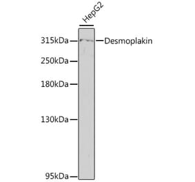 Western Blot - Anti-Desmoplakin Antibody (A89203) - Antibodies.com