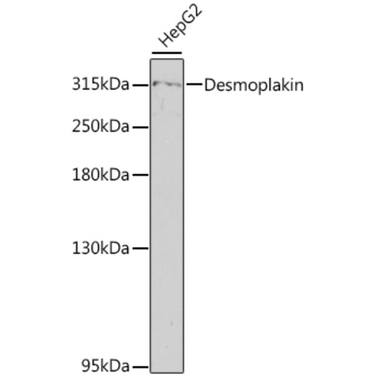 Western Blot - Anti-Desmoplakin Antibody (A89203) - Antibodies.com