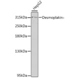 Western Blot - Anti-Desmoplakin Antibody (A89203) - Antibodies.com