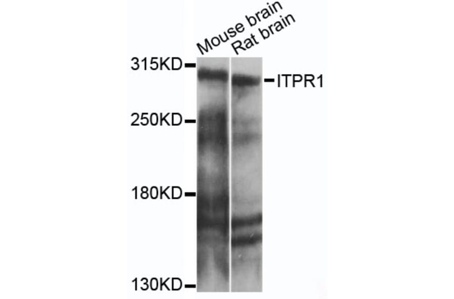 Western Blot - Anti-ITPR1 Antibody (A14008) - Antibodies.com