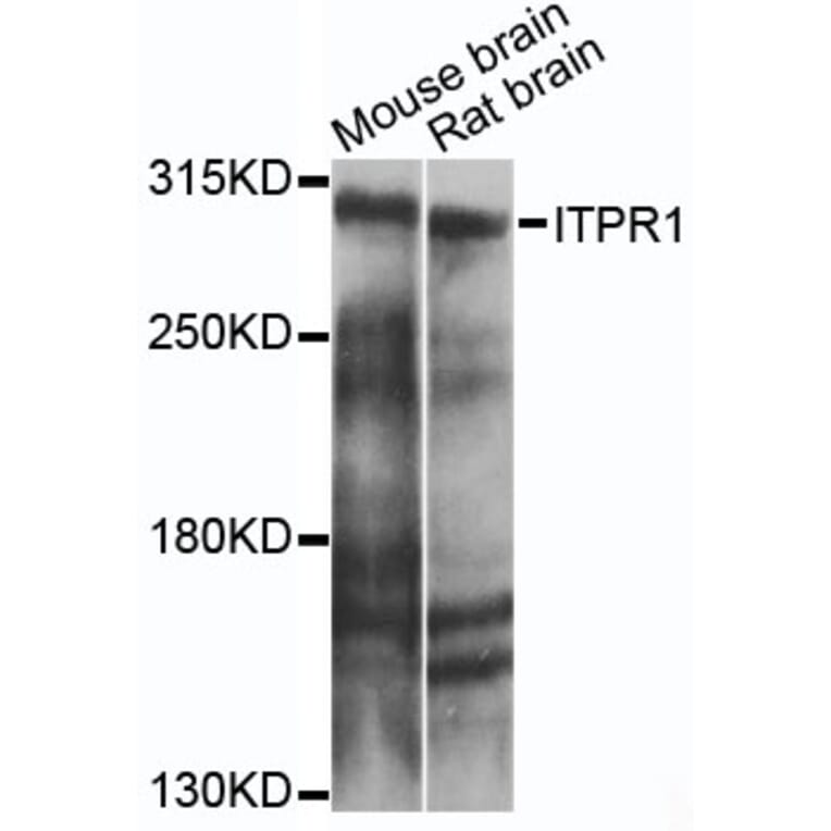 Western Blot - Anti-ITPR1 Antibody (A14008) - Antibodies.com