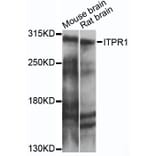 Western Blot - Anti-ITPR1 Antibody (A14008) - Antibodies.com