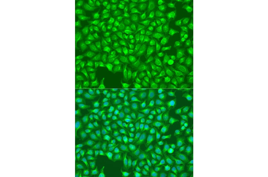 Immunofluorescence - Anti-ITPR1 Antibody (A14008) - Antibodies.com