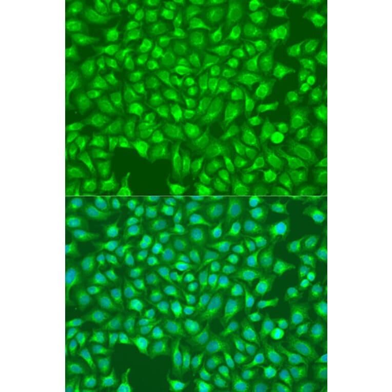Immunofluorescence - Anti-ITPR1 Antibody (A14008) - Antibodies.com
