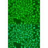 Immunofluorescence - Anti-ITPR1 Antibody (A14008) - Antibodies.com