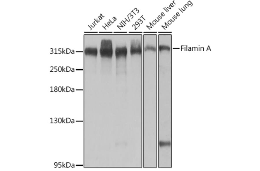 Western Blot - Anti-Filamin A Antibody (A89205) - Antibodies.com