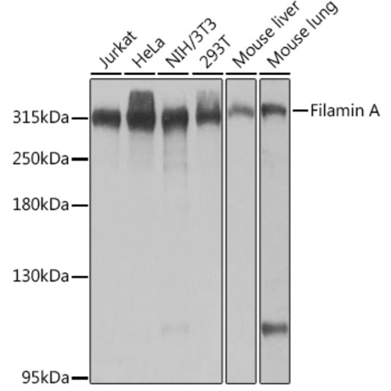 Western Blot - Anti-Filamin A Antibody (A89205) - Antibodies.com