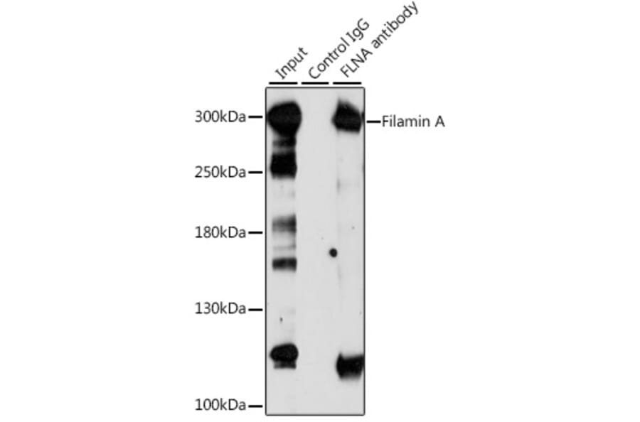 Western Blot - Anti-Filamin A Antibody (A89205) - Antibodies.com