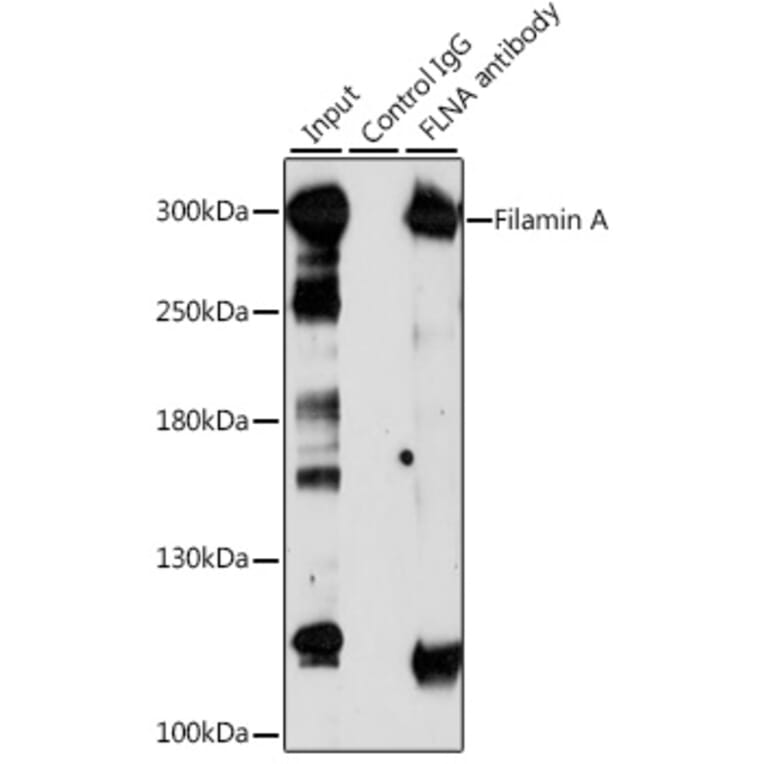 Western Blot - Anti-Filamin A Antibody (A89205) - Antibodies.com