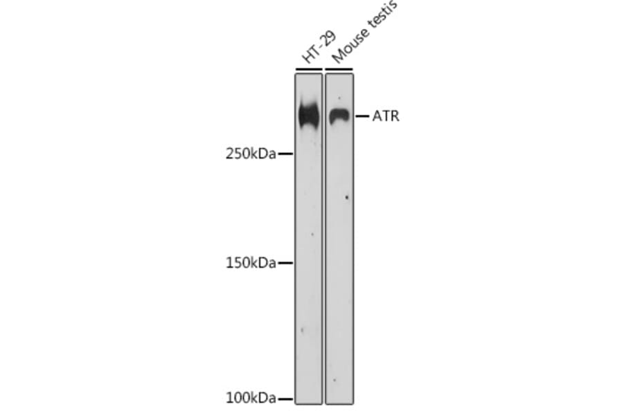 Western Blot - Anti-ATR Antibody (A89206) - Antibodies.com