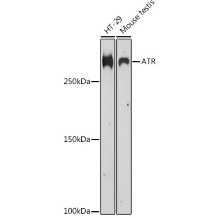 Western Blot - Anti-ATR Antibody (A89206) - Antibodies.com