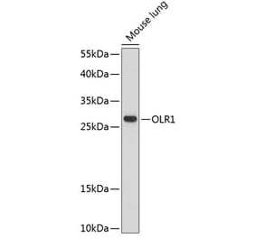 Western Blot - Anti-LOX 1 Antibody (A89207) - Antibodies.com