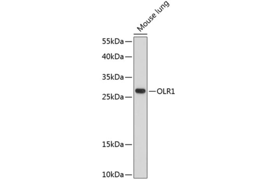 Western Blot - Anti-LOX 1 Antibody (A89207) - Antibodies.com
