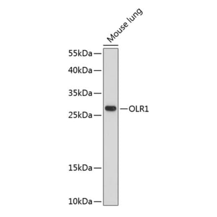 Western Blot - Anti-LOX 1 Antibody (A89207) - Antibodies.com