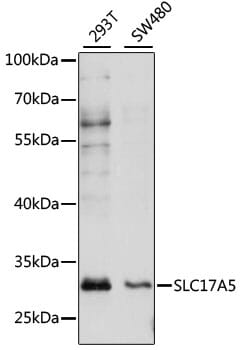 Western blot analysis of extracts of various cell lines, using Anti-SLC17A5 Antibody (A15425) at 1:1,000 dilution.
Secondary antibody: Goat Anti-Rabbit IgG (H+L) (HRP) (AS014) at 1:10,000 dilution.
Lysates / proteins: 25µg per lane.
Blocking buffer: 3% non-fat dry milk in TBST.
Detection: ECL Basic Kit (RM00020).
Exposure time: 60s.