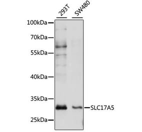 Western Blot - Anti-SLC17A5 Antibody (A89208) - Antibodies.com