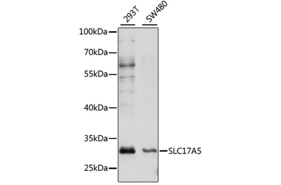 Western Blot - Anti-SLC17A5 Antibody (A89208) - Antibodies.com