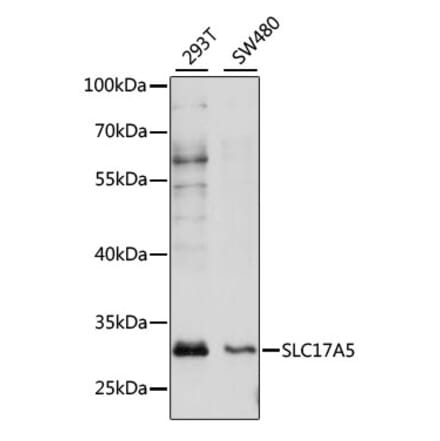 Western Blot - Anti-SLC17A5 Antibody (A89208) - Antibodies.com