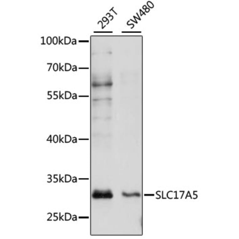 Western Blot - Anti-SLC17A5 Antibody (A89208) - Antibodies.com
