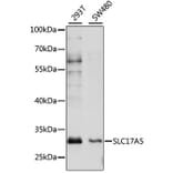 Western Blot - Anti-SLC17A5 Antibody (A89208) - Antibodies.com