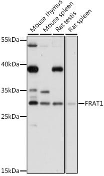 Western blot analysis of extracts of various cell lines, using Anti-FRAT1 Antibody (A16093) at 1:1,000 dilution.
Secondary antibody: Goat Anti-Rabbit IgG (H+L) (HRP) (AS014) at 1:10,000 dilution.
Lysates / proteins: 25µg per lane.
Blocking buffer: 3% non-fat dry milk in TBST.
Detection: ECL Basic Kit (RM00020).
Exposure time: 5s.
