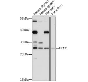 Western Blot - Anti-FRAT1 Antibody (A89209) - Antibodies.com