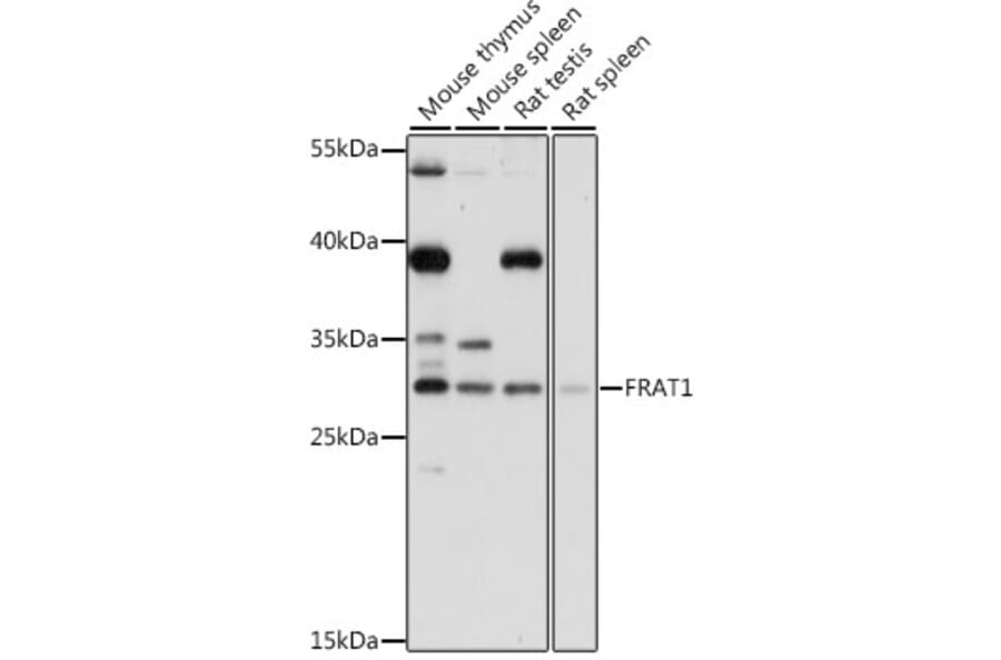 Western Blot - Anti-FRAT1 Antibody (A89209) - Antibodies.com