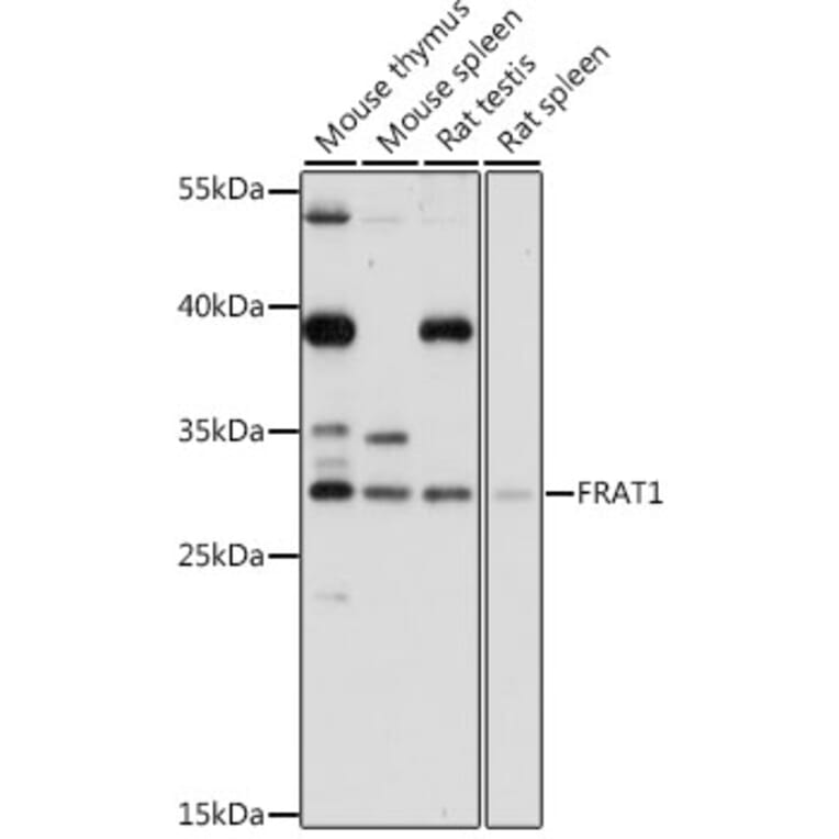 Western Blot - Anti-FRAT1 Antibody (A89209) - Antibodies.com