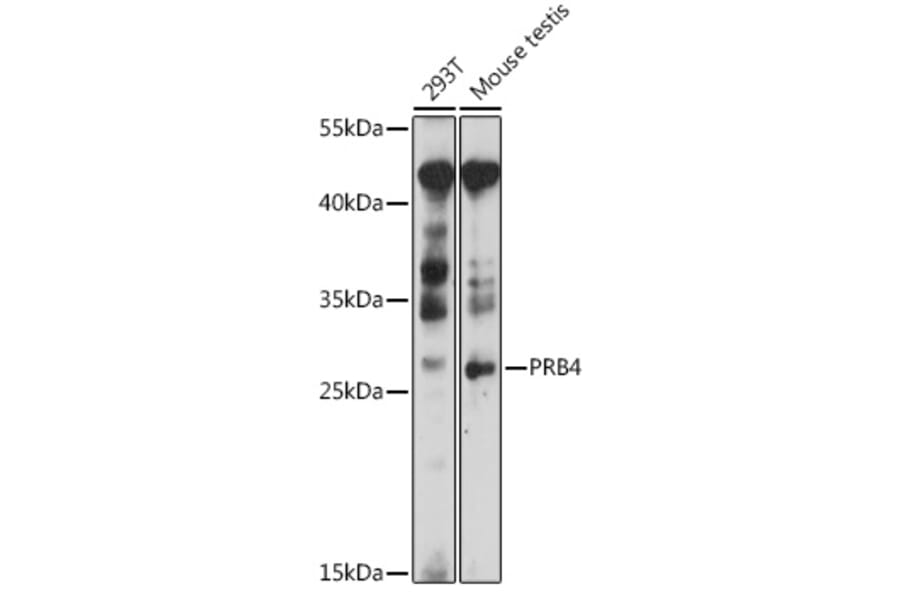 Western Blot - Anti-PRB4 Antibody (A89210) - Antibodies.com
