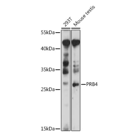Western Blot - Anti-PRB4 Antibody (A89210) - Antibodies.com