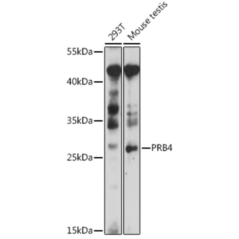 Western Blot - Anti-PRB4 Antibody (A89210) - Antibodies.com