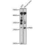 Western Blot - Anti-PRB4 Antibody (A89210) - Antibodies.com