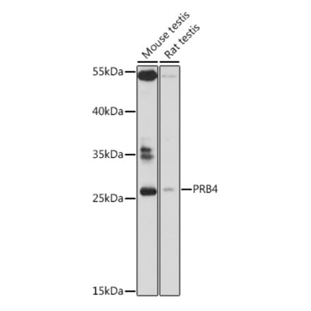 Western Blot - Anti-PRB4 Antibody (A89211) - Antibodies.com