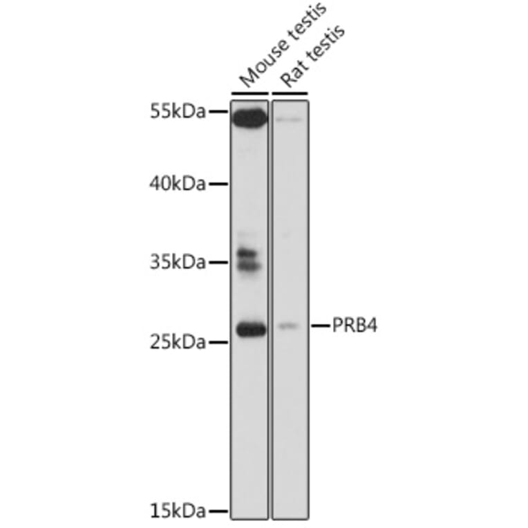 Western Blot - Anti-PRB4 Antibody (A89211) - Antibodies.com