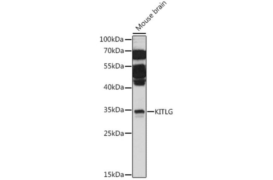 Western Blot - Anti-SCF Antibody (A89212) - Antibodies.com