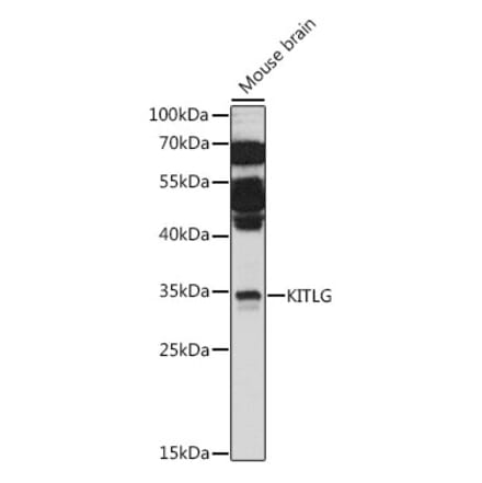 Western Blot - Anti-SCF Antibody (A89212) - Antibodies.com