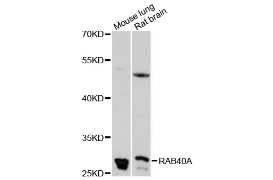 Western Blot - Anti-RAB40A Antibody (A13236) - Antibodies.com
