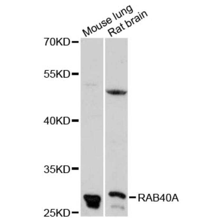 Western Blot - Anti-RAB40A Antibody (A13236) - Antibodies.com