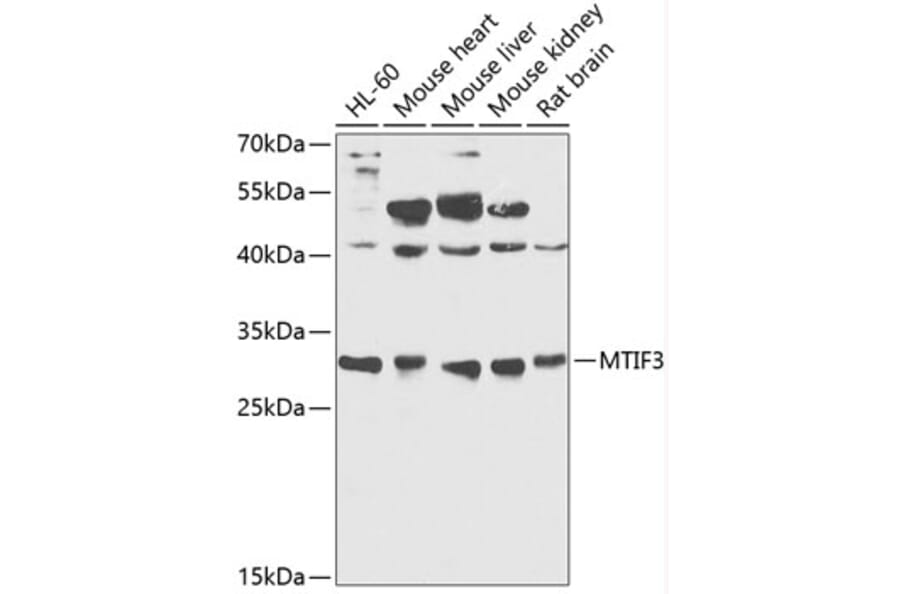 Western Blot - Anti-MTIF3 Antibody (A89214) - Antibodies.com