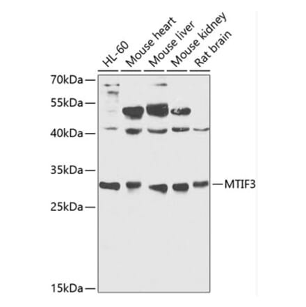Western Blot - Anti-MTIF3 Antibody (A89214) - Antibodies.com