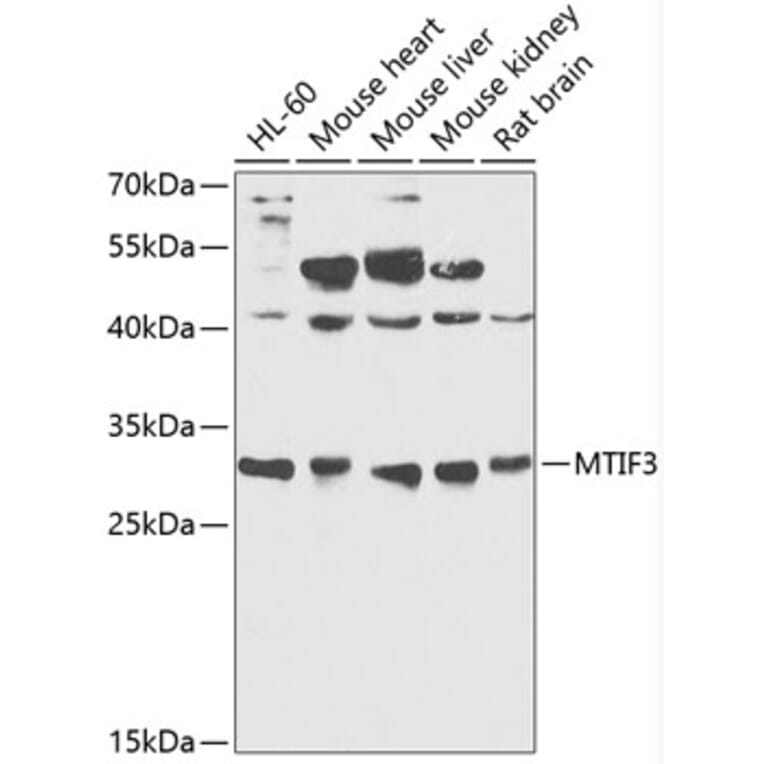 Western Blot - Anti-MTIF3 Antibody (A89214) - Antibodies.com
