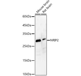 Western Blot - Anti-NRIP2 Antibody (A89215) - Antibodies.com